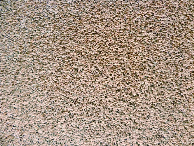 スポンジタイプ 